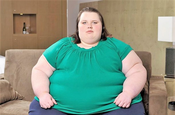 Người béo phì có nguy cơ bị suy tim cao gấp đôi người cân nặng bình thường